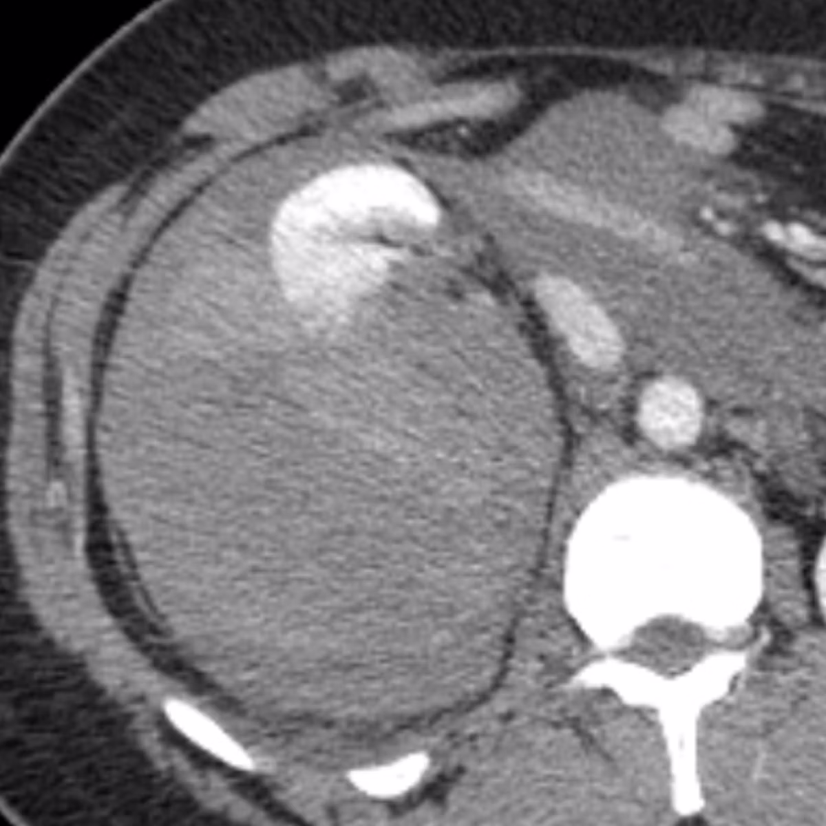 Sample case from CT Trauma: Chest, Abdo